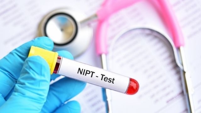 japan non invasive prenatal testing nipt